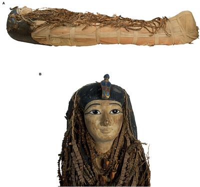 Digital Unwrapping of the Mummy of King Amenhotep I (1525–1504 BC) Using CT